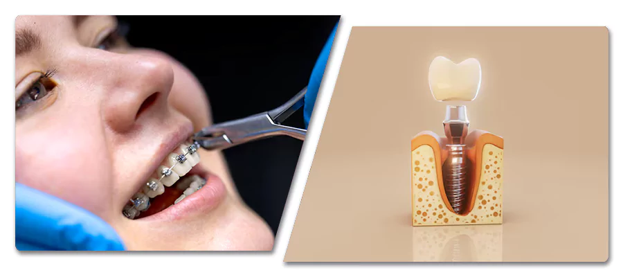 خدمات مختلف دندانپزشکی